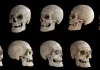 What Are the Different Skull Landmarks?