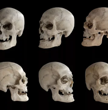 What Are the Different Skull Landmarks?